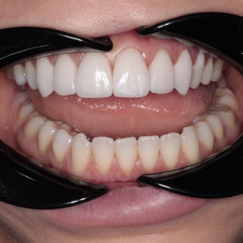 Space of Smiles, Винница Фото - 5