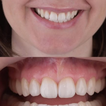 Алексей Петренко, Винница Фото - 5