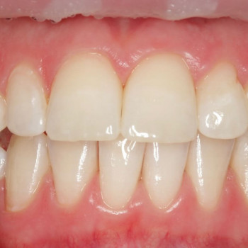 Андрій Іскра, Вінниця Фото - 5