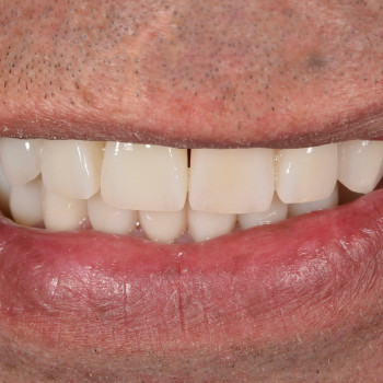 Ольга Богданцева, Вінниця Фото - 5