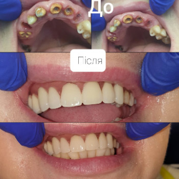 Євген Нянькін, Вінниця Фото - 5