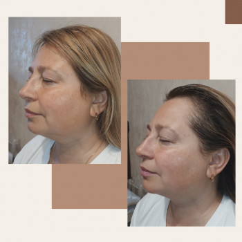 Катерина Данькова, Чернигов Фото - 10