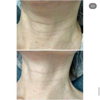 Олена Половинка, Черкассы Фото - 8