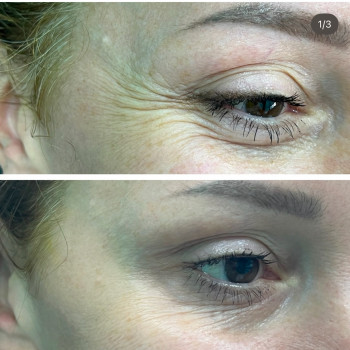 Олена Половинка, Черкассы Фото - 10