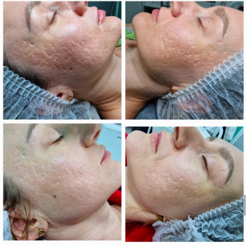 Олена Половинка, Черкассы Фото - 11