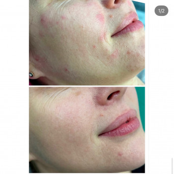 Олена Половинка, Черкассы Фото - 15