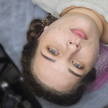 Корекція через 1-2 місяця.  