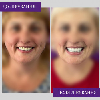 MDent, Днепр Фото - 5