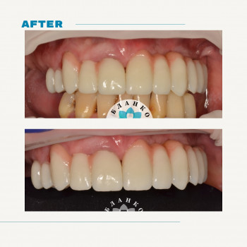 Бланко, Дніпро Фото - 5