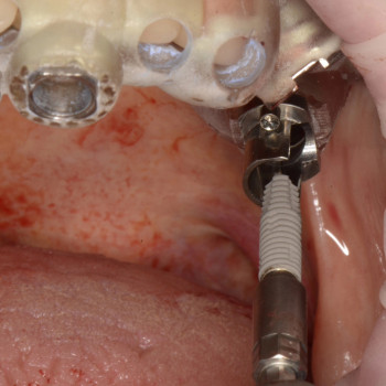 Євген Нєженцев, Дніпро Фото - 5