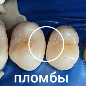 Vitadent, Днепр Фото - 5