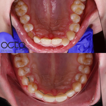 OCTA, Днепр Фото - 5