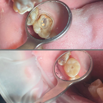 Антон Головатый, Днепр Фото - 5