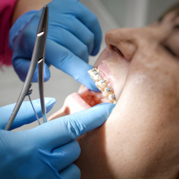 StomClinic, Днепр Фото - 5