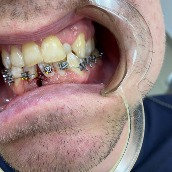 Віра Васюченко, Дніпро Фото - 5