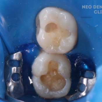 Neo Dental Clinic, Дніпро Фото - 5