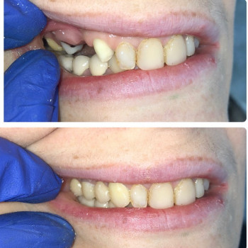 Anar Dzhalilov, Днепр Фото - 5