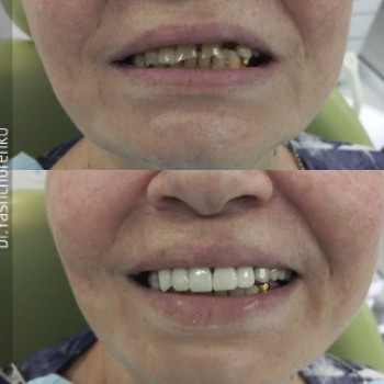 Виталий Ящуренко, Днепр Фото - 5