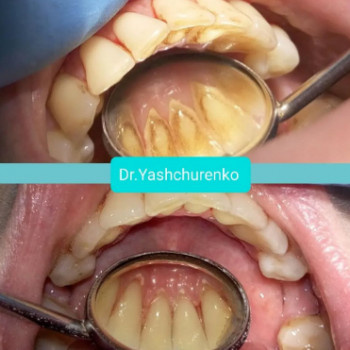 Виталий Ящуренко, Днепр Фото - 6