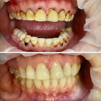 Denta Look, Житомир Фото - 5