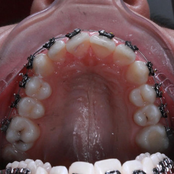 Piranha Dental, Запорожье Фото - 5