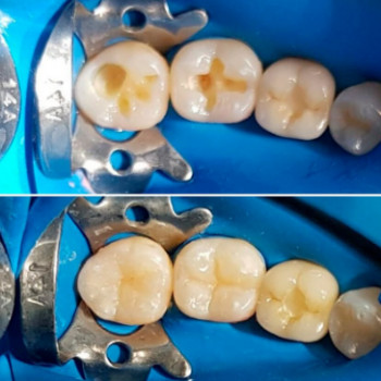 Хюгге Med, Запоріжжя Фото - 5