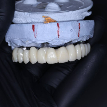 Фото з портфоліо фахівця Петро Мосійчук (стоматолог, Рівне)