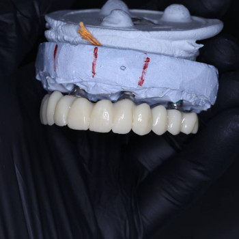 Фото з портфоліо фахівця Петро Мосійчук (стоматолог, Рівне)