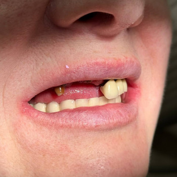 Фото з портфоліо фахівця Петро Мосійчук (стоматолог, Рівне)