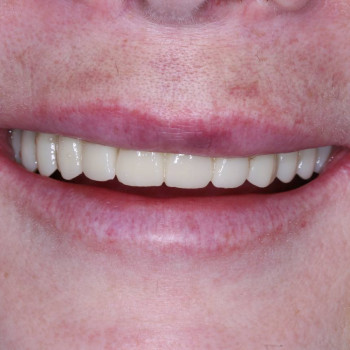 Фото з портфоліо фахівця Петро Мосійчук (стоматолог, Рівне)