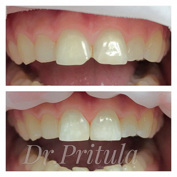 Crystal Shine, Запоріжжя Фото - 5