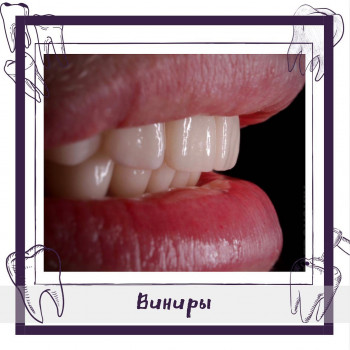 ЗФ Стоматология, Запорожье Фото - 5