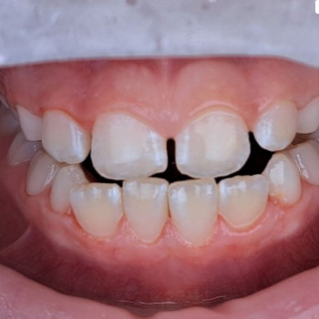 V.Dent, Запоріжжя Фото - 5