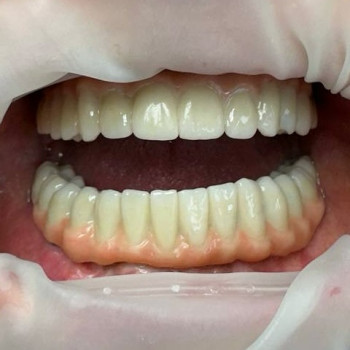 Diulmezov, Запорожье Фото - 5