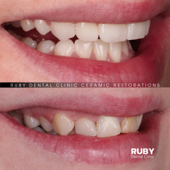 Олексій Кухаревич, Рівне Фото - 21