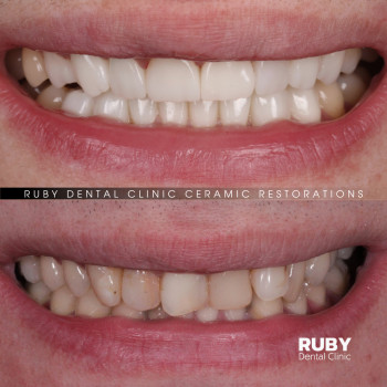 Олексій Кухаревич, Рівне Фото - 23