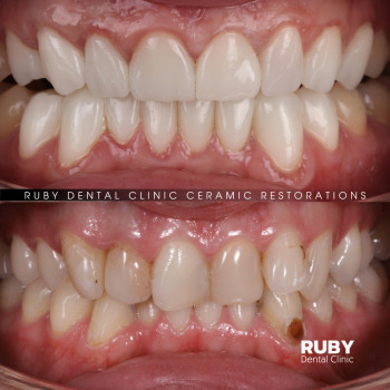 Олексій Кухаревич, Рівне Фото - 25