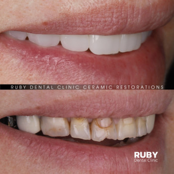 Олексій Кухаревич, Рівне Фото - 2