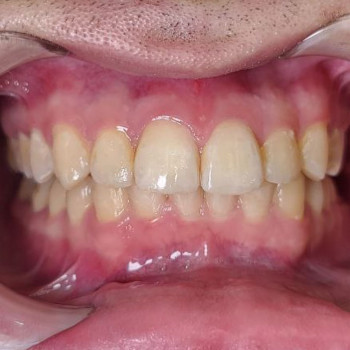 Дентея, Запорожье Фото - 5