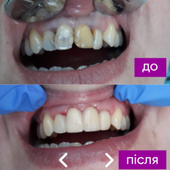 Фудзи, Запорожье Фото - 5