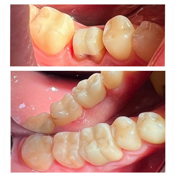 KISS Dental, Ивано-Франковск Фото - 5