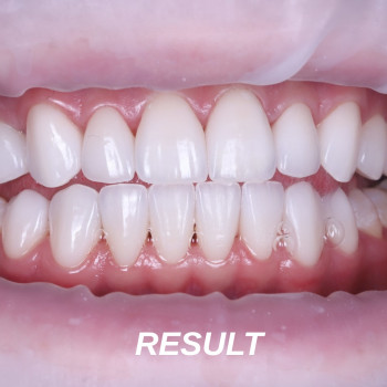 Dr. Ali Dental Center, Івано-Франківськ Фото - 5