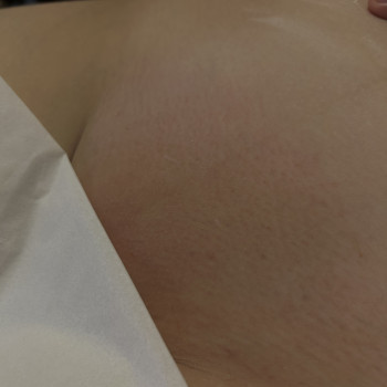 Глибоке бікіні, 30 хвилин, 380 грн