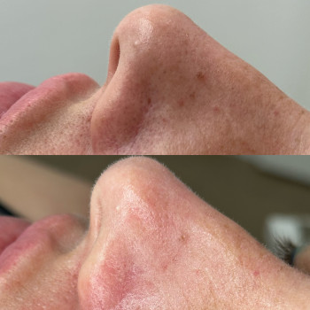 Христина Українська, Буча Фото - 40