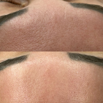 Христина Українська, Буча Фото - 41