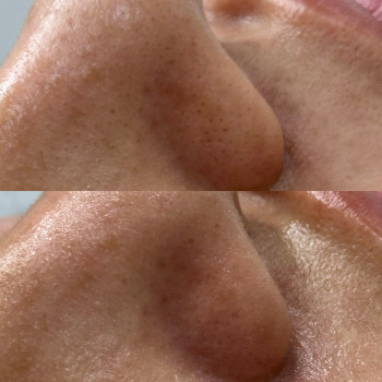 Христина Українська, Буча Фото - 47