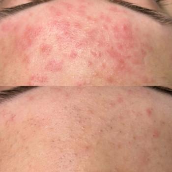 Христина Українська, Буча Фото - 49