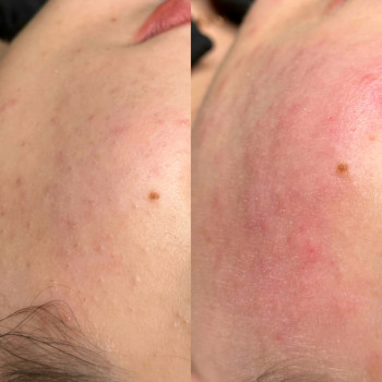 Христина Українська, Буча Фото - 50