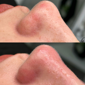 Христина Українська, Буча Фото - 36