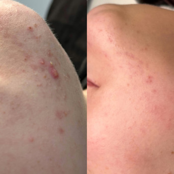 Христина Українська, Буча Фото - 64